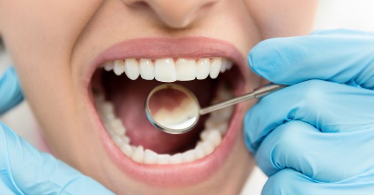 [SALUD] ¿Cuáles son las enfermedades dentales más comunes, su detección y tratamiento?