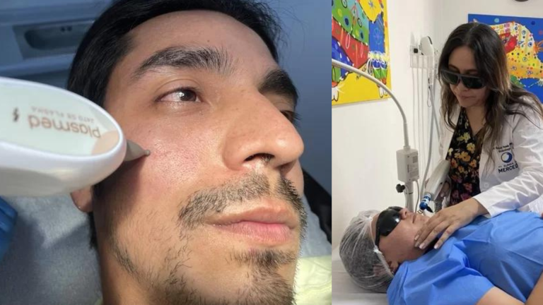 Salud | ¿Las cicatrices de acné te impiden lucir una piel suave y uniforme? 