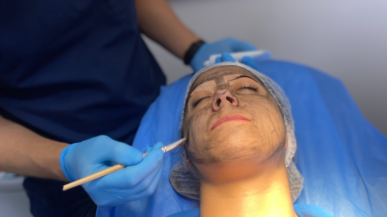 Salud | Carbón Peel: Tratamiento Médico y Láser