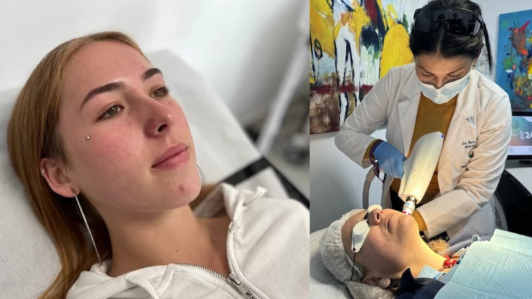 Salud | Rejuvenecimiento facial