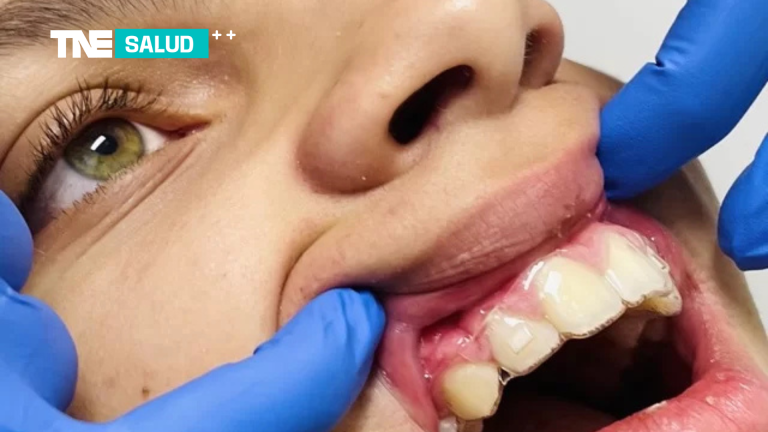 Salud | Ortodoncia invisible