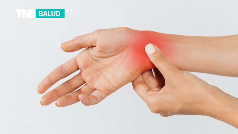 Salud | Síndrome del Túnel Carpiano