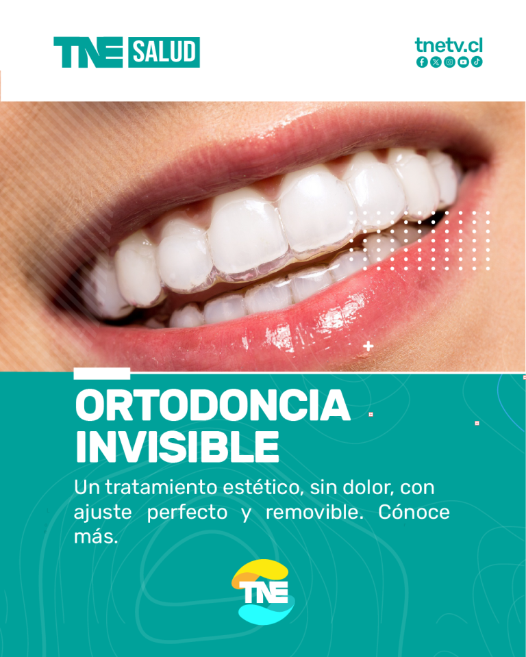 TNE Salud | Ortodoncia Invisible