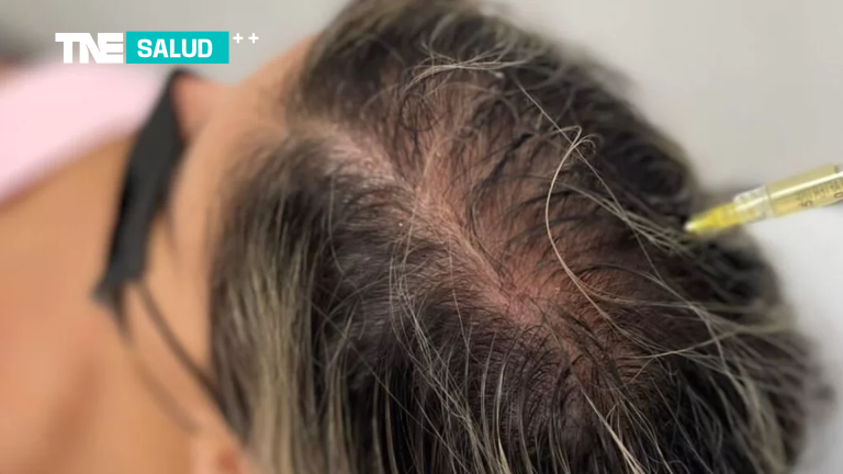 Salud | Plasma Rico en Plaquetas Capilar